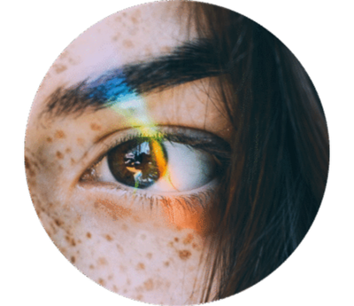 Close-up of a freckled eye with a rainbow reflection across the iris.